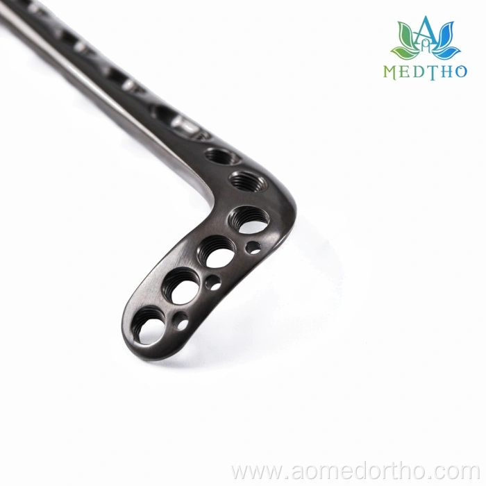 anterolateral distal tibia locking plate